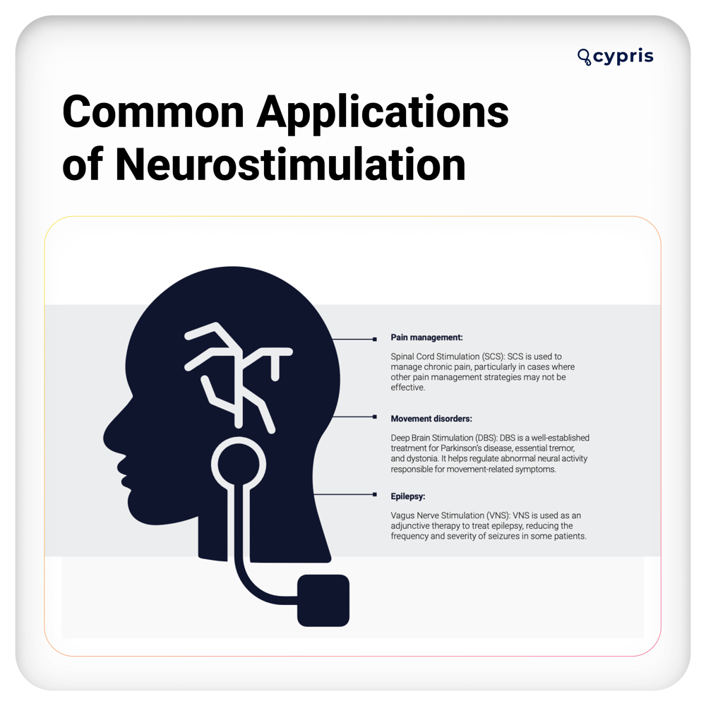 Neurotimulation report